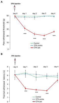 Neuronal P2X4 receptor may contribute to peripheral inflammatory pain in rat spinal dorsal horn